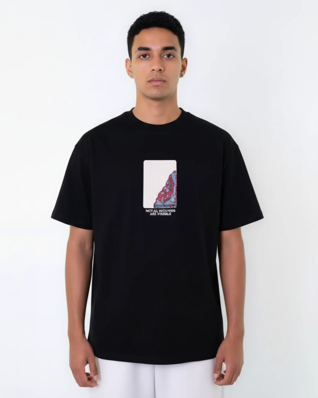 Oversized Graphic Tee - Tropical 01